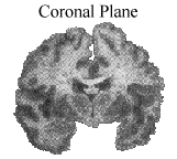 Coronal.gif (13243 bytes)